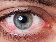 Spojrzenie na strukturę krótkowzrocznego oka